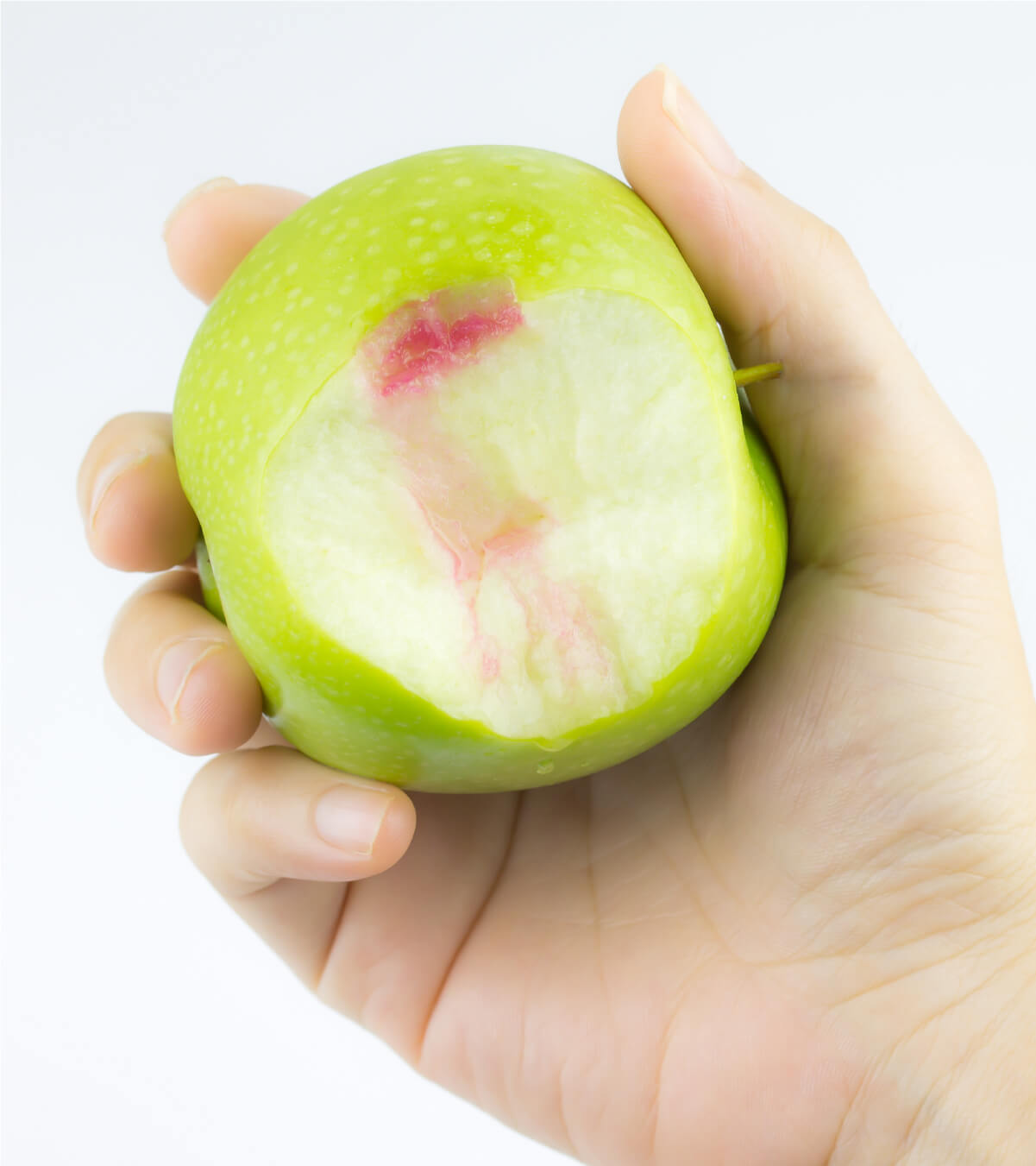 What Are Dental Crowns?